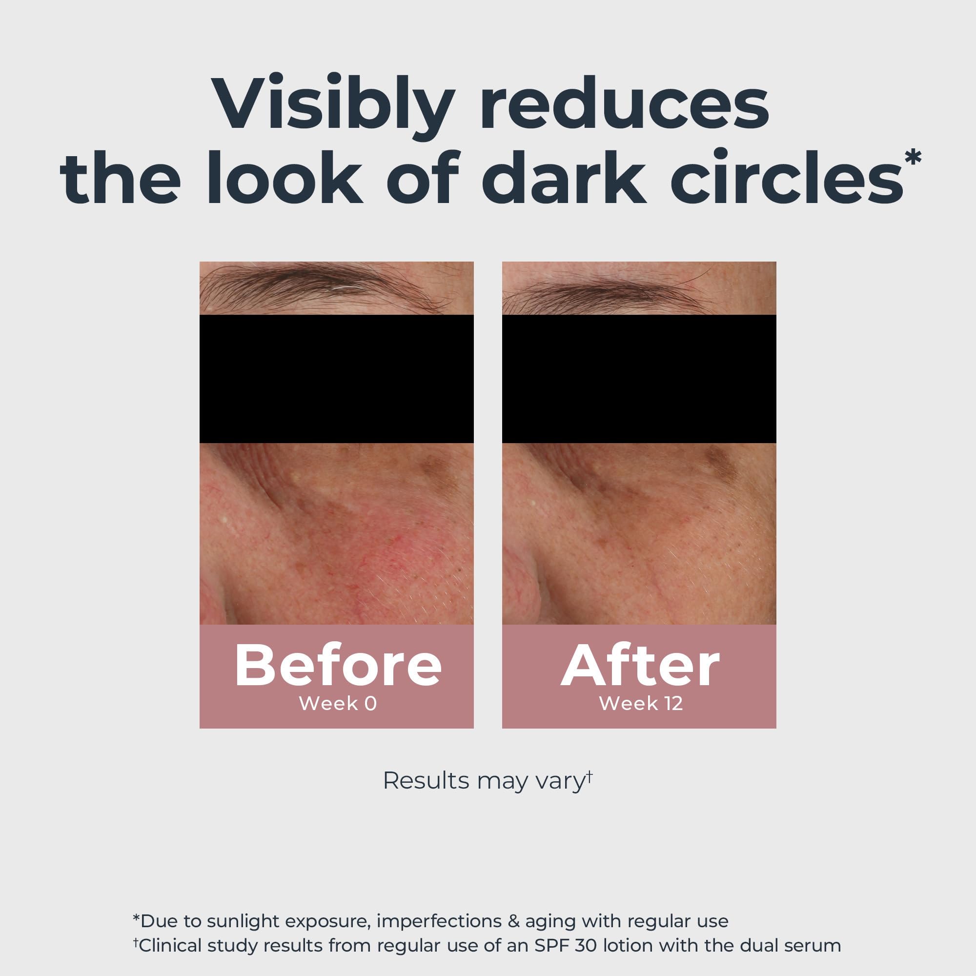 Eucerin Radiant Tone Eye Cream Thiamidol close-up highlights dark-circle correction.