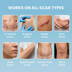 Eva Naturals scar tape roll packaging highlights reusable, washable design for long-term scar management