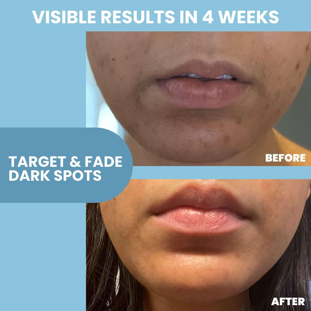 Eva Naturals Niacinamide serum close-up demonstrates pore-minimized, matte complexion
