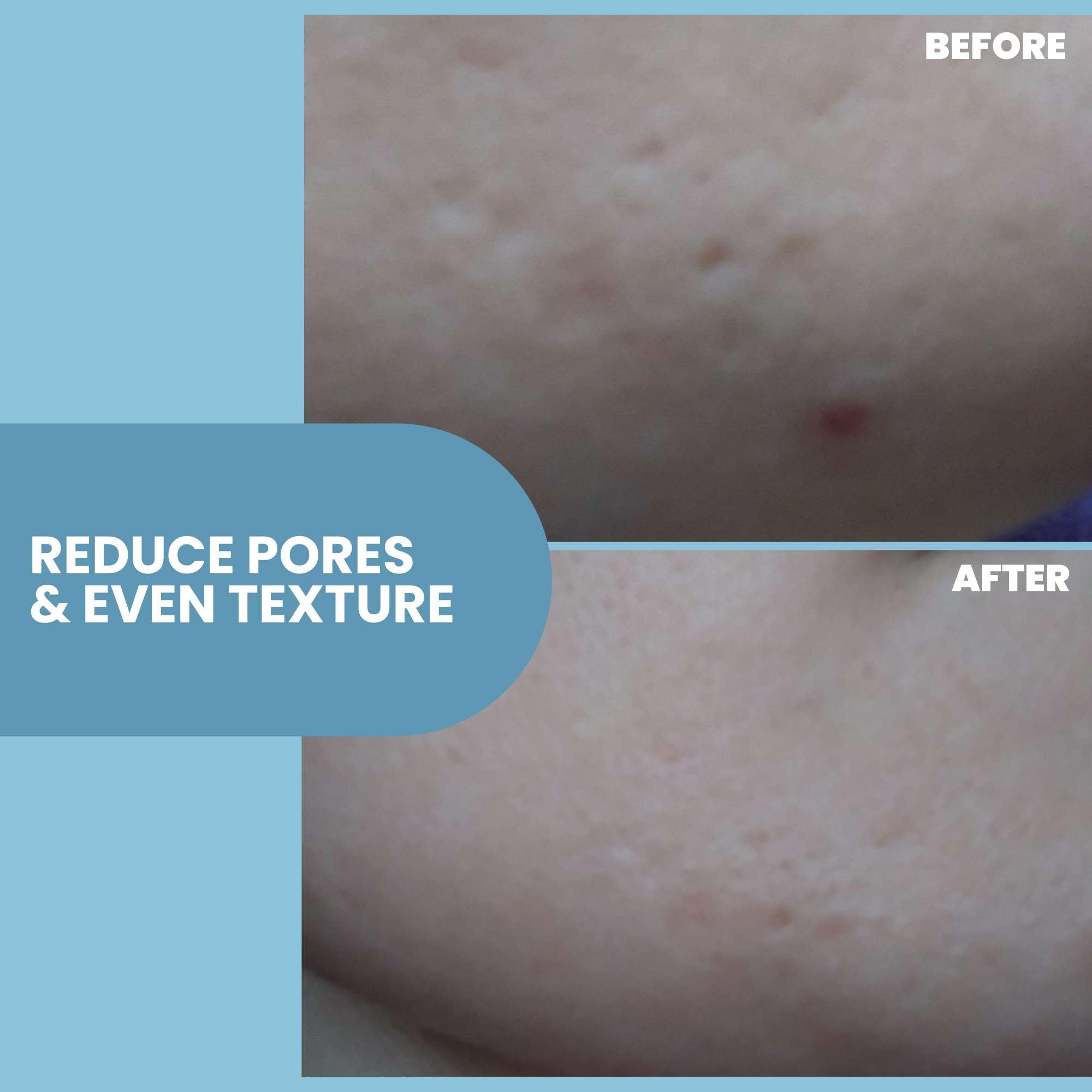 Eva Naturals niacinamide serum pore-refinement close-up showcases even tone.