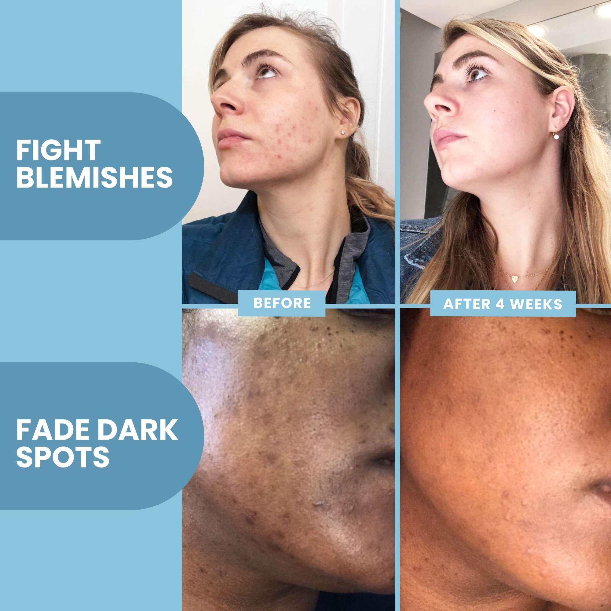 Eva Naturals Vitamin C Serum applying to cheek demonstrates quick absorption and smoothing benefits.
