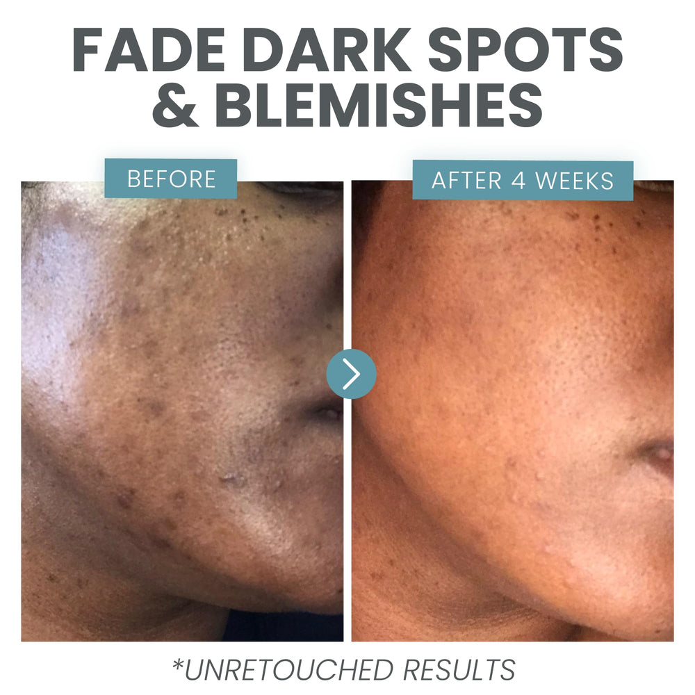 Porcelain skin closeup suggests brightened tone and smoother texture.