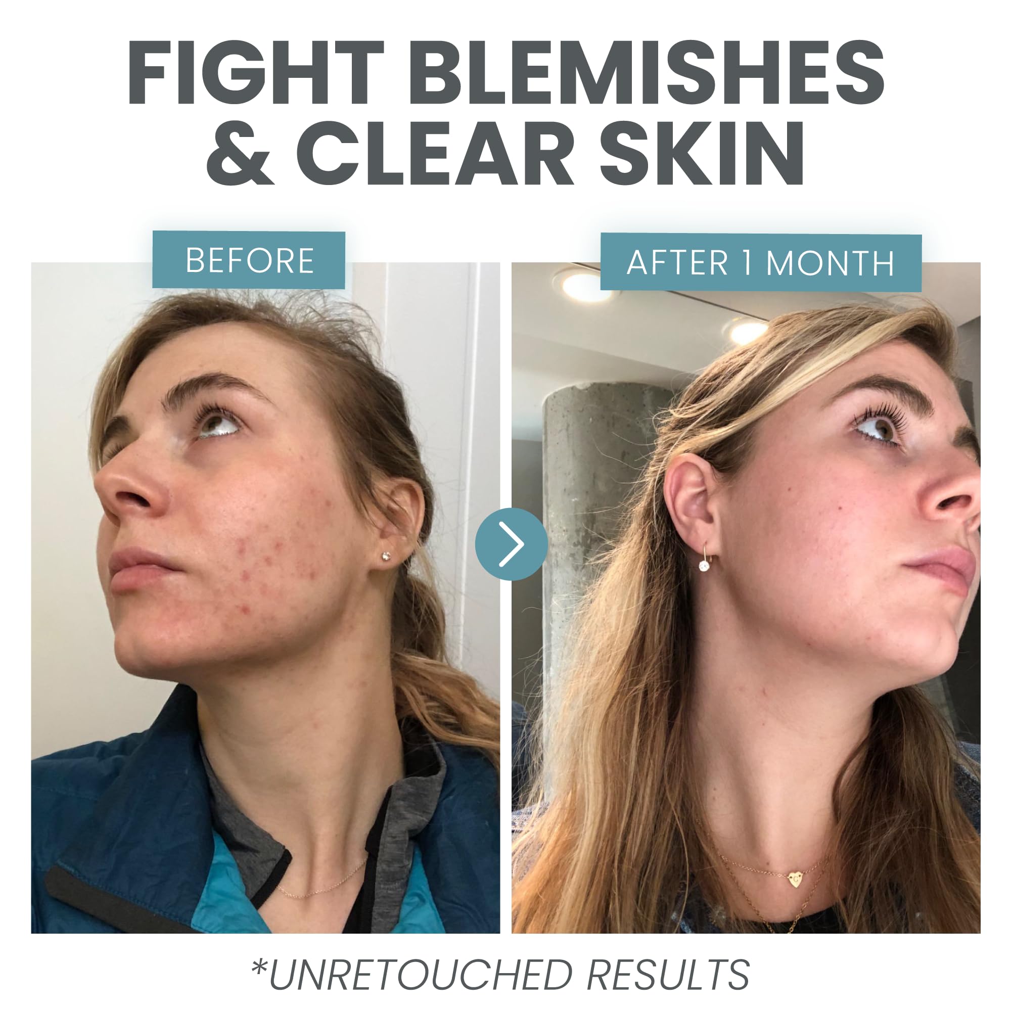 Ingredient Niacinamide and Hyaluronic Acid illustration emphasizes hydrated, balanced skin benefits.