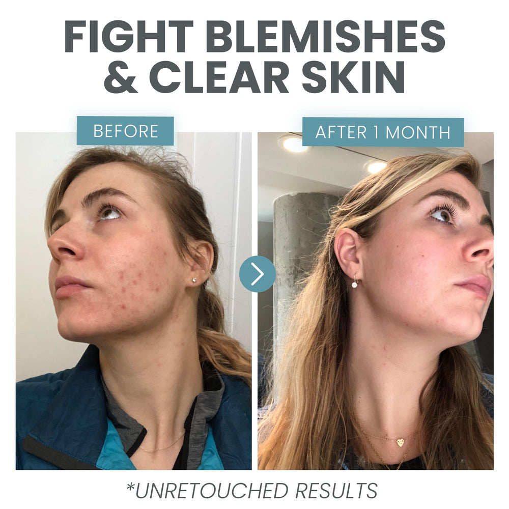 Ingredient Niacinamide and Hyaluronic Acid illustration emphasizes hydrated, balanced skin benefits.