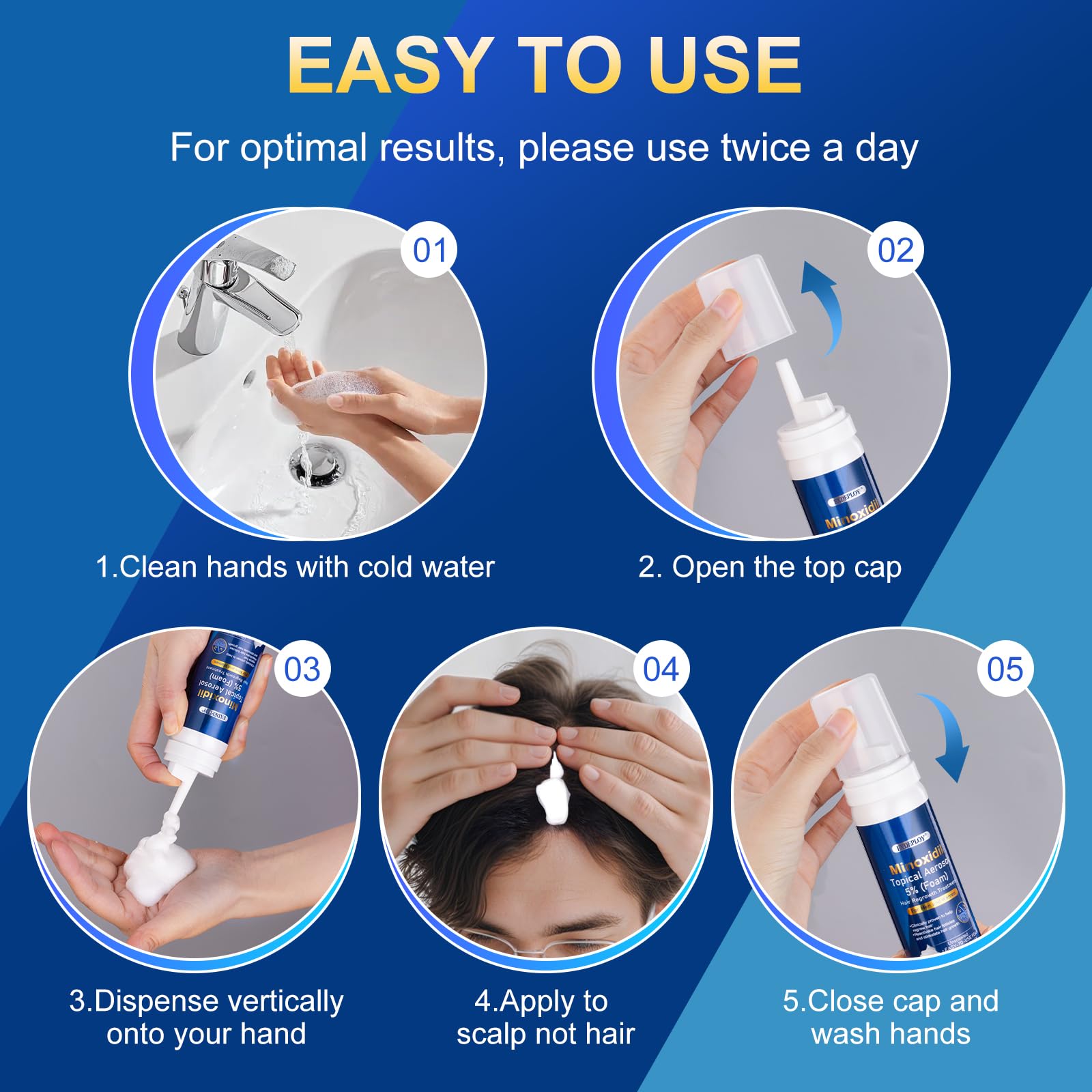 ExDeploy minoxidil foam full-size bottle signals a 5-month supply option