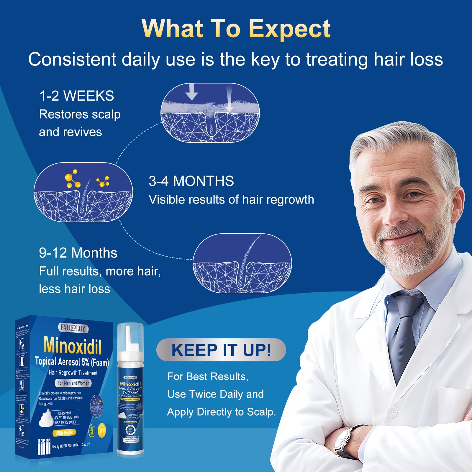 Exdeploy minoxidil foam on scalp application targeting thinning areas