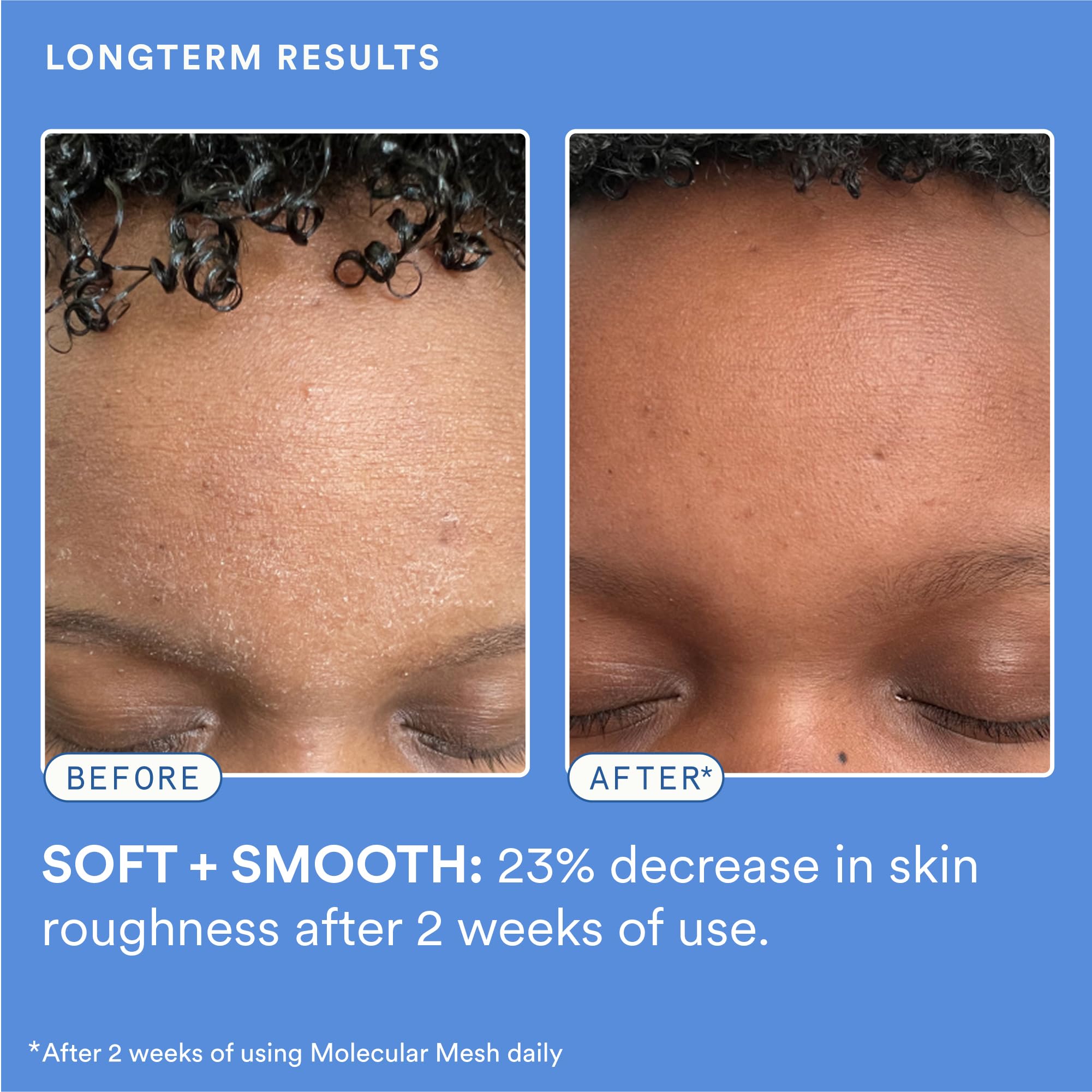 Experiment Molecular Mesh Barrier Repair applied on the face demonstrating fast absorption