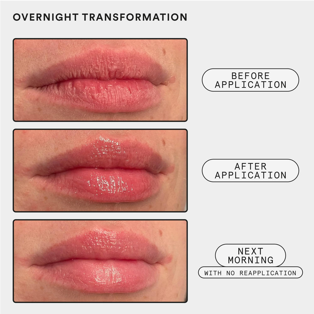 Experiment Softwear gentle AHA exfoliation smooths flaky lips without irritation.