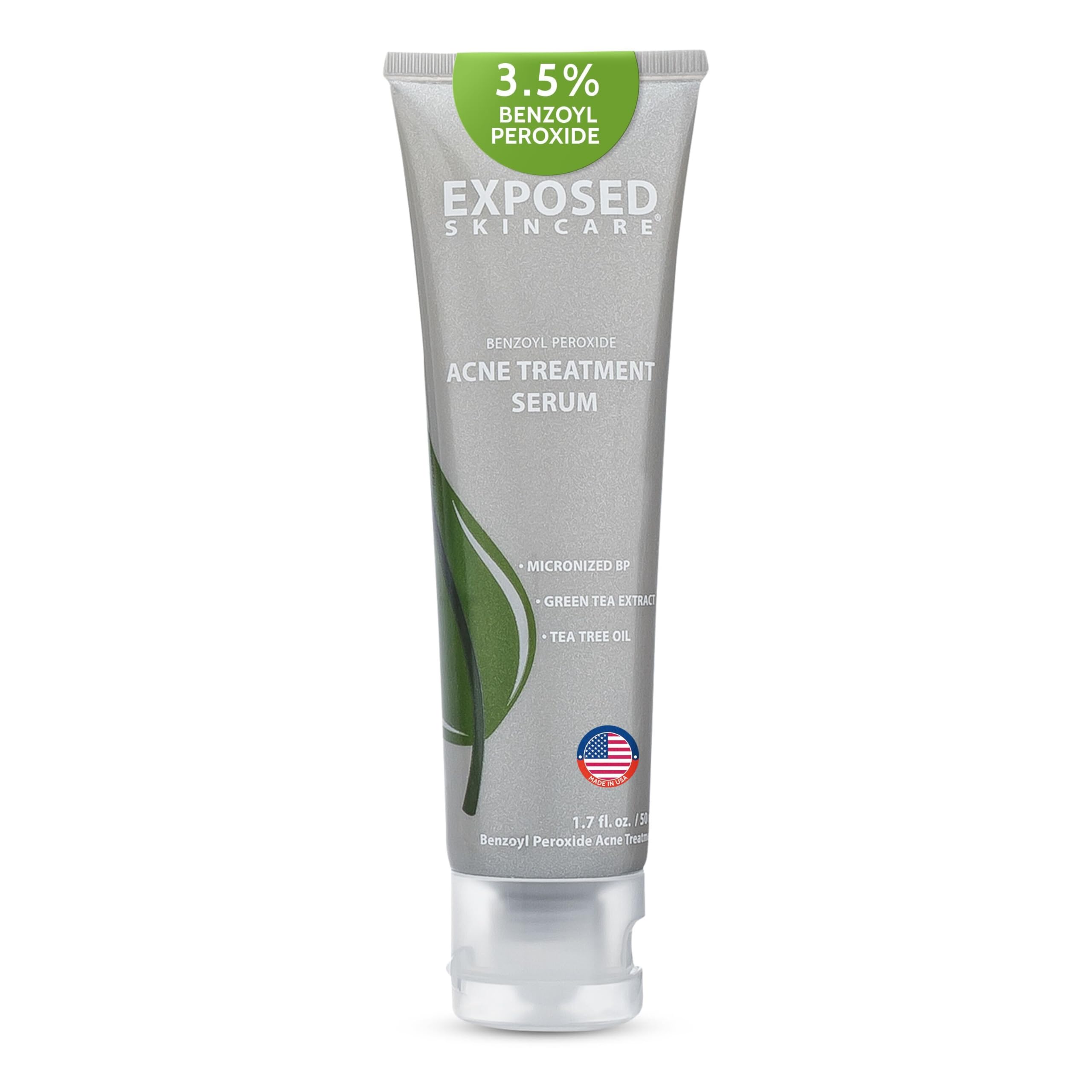 Exposed Skin Care serum bottle closeup highlighting a lightweight acne treatment for clearer skin