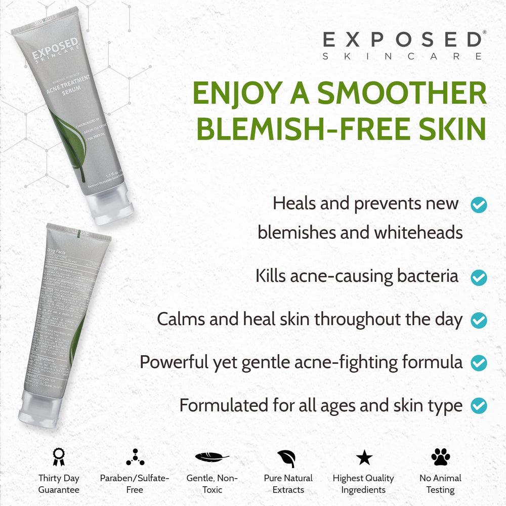 Exposed Skin Care spot treatment on pimples demonstrates fast-acting blemish relief