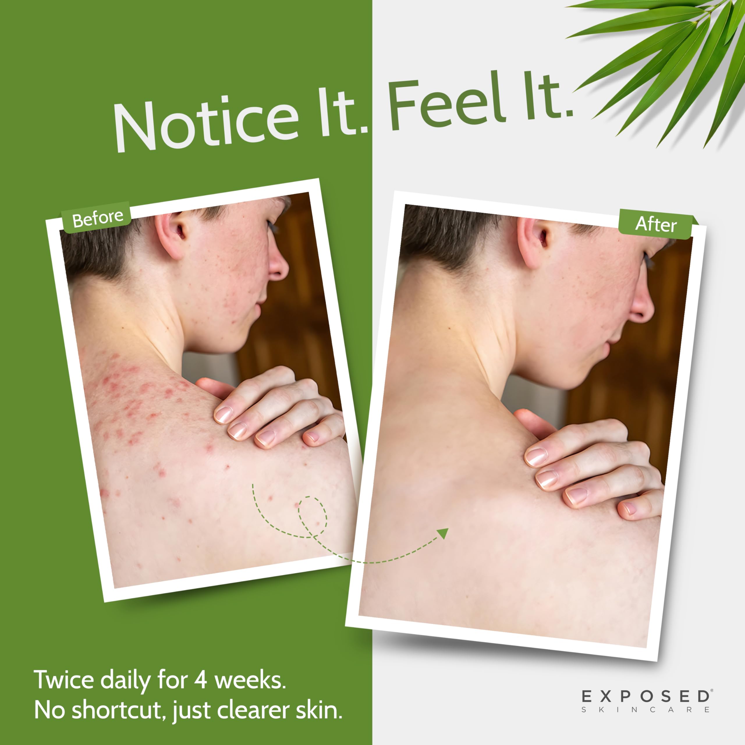 Exposed Skin Care tri-powered body wash lather closeup demonstrates exfoliation and cleansing.