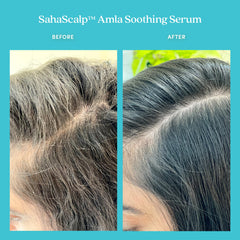 Fable & Mane Amla Serum rose oil drop illustrates nourishing aroma.