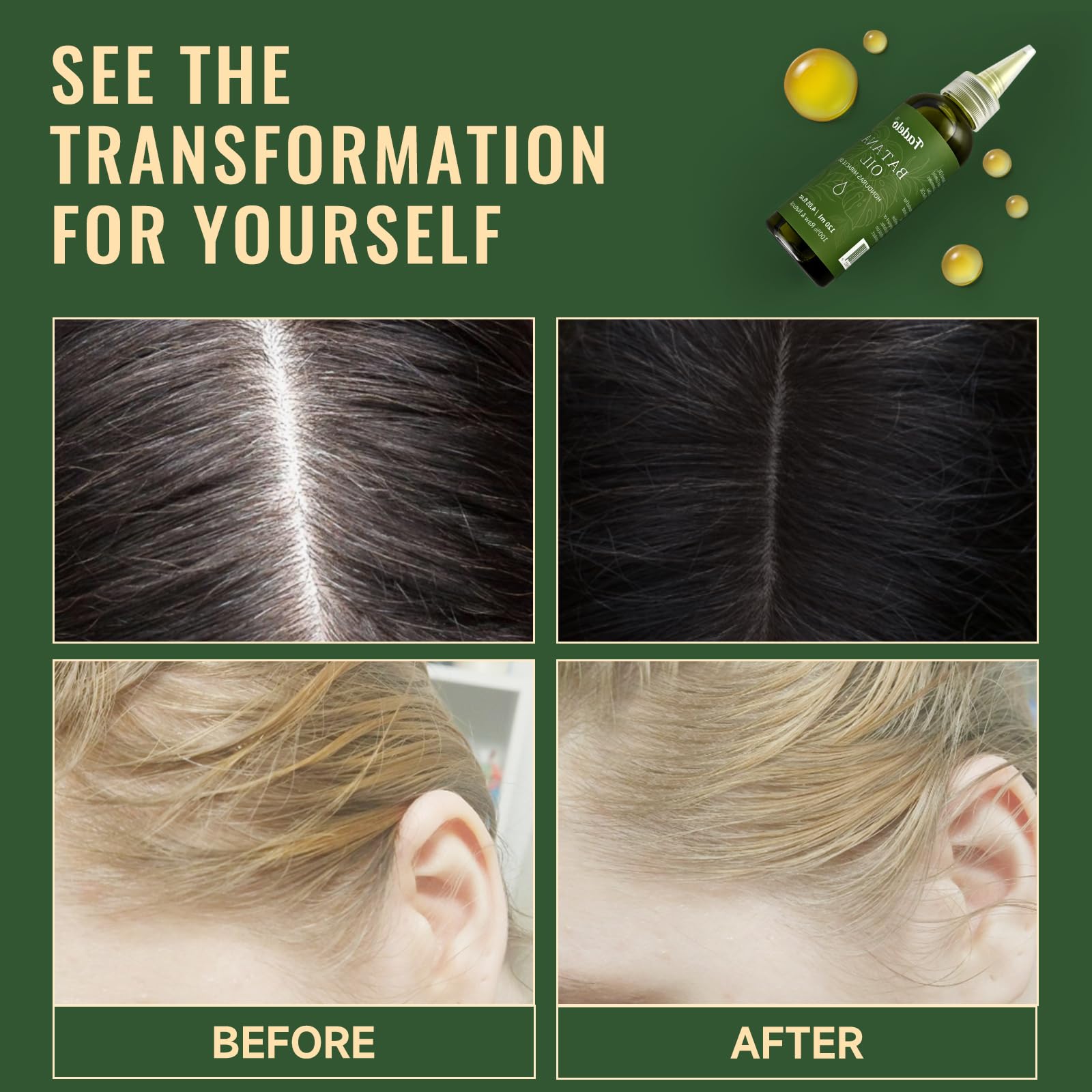 Fadelo Batana Oil packaging display—100% natural, chemical-free hair treatment