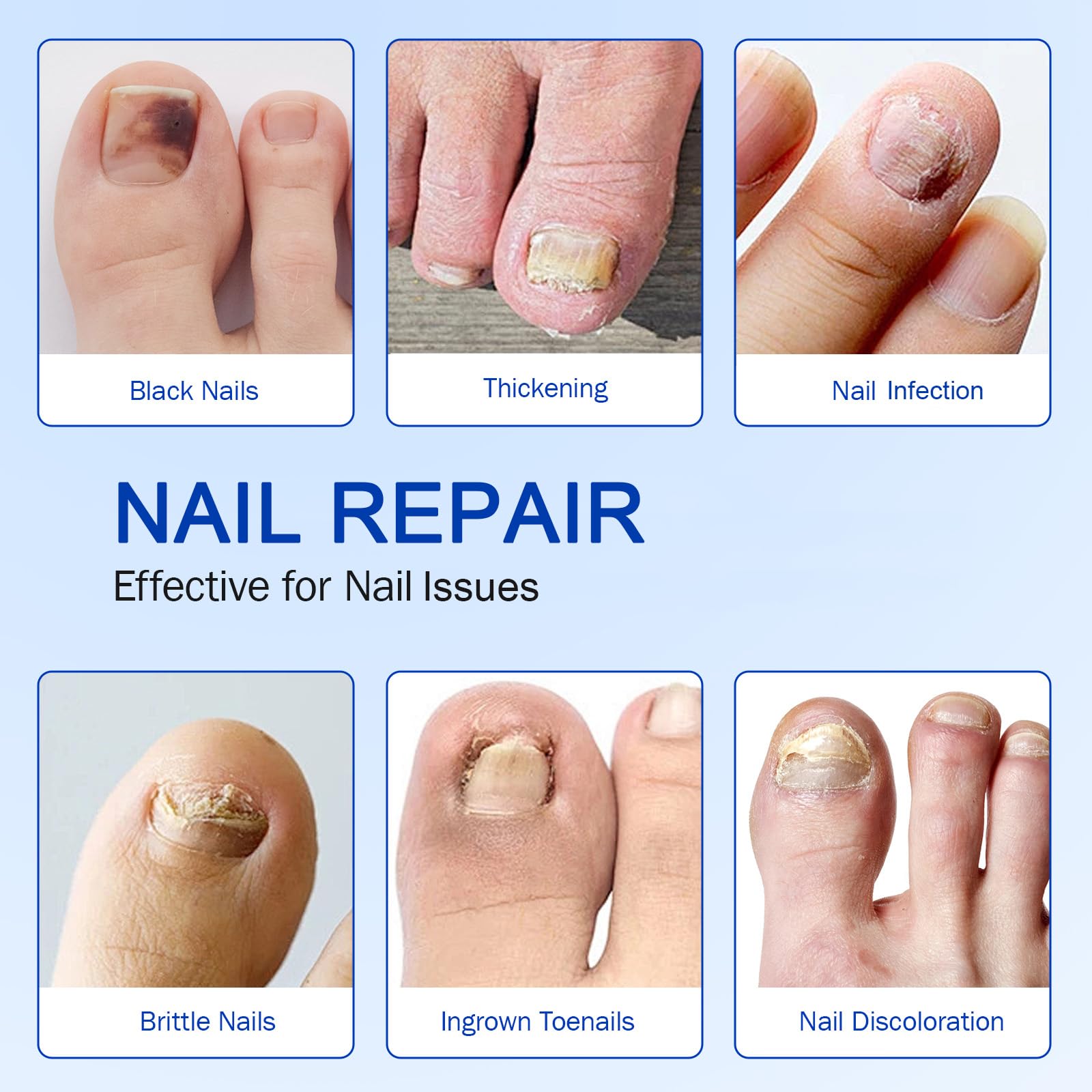 FANSHI patches before after on nails illustrate improved appearance potential.