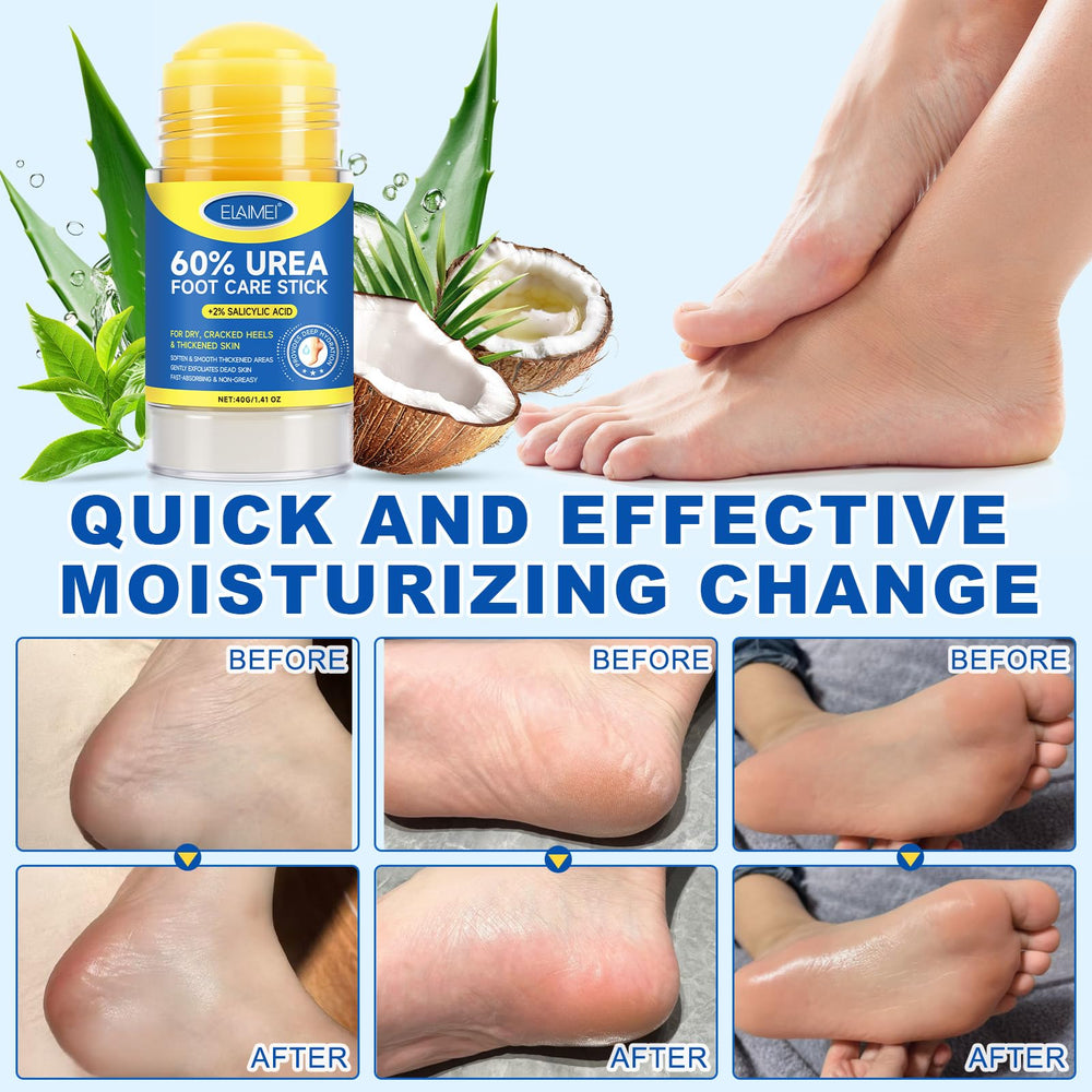 FANSHI skin softened after using the 60 percent urea stick