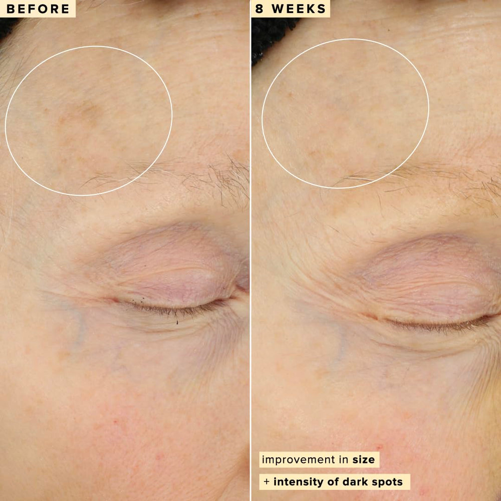 Farmacy serum designed for AM and PM use with SPF guidance.