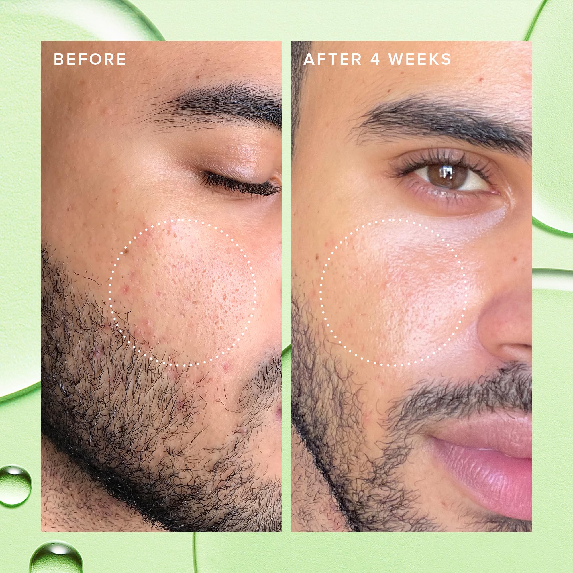 Farmacy toner with 2% BHA targets oil buildup for a calmer complexion
