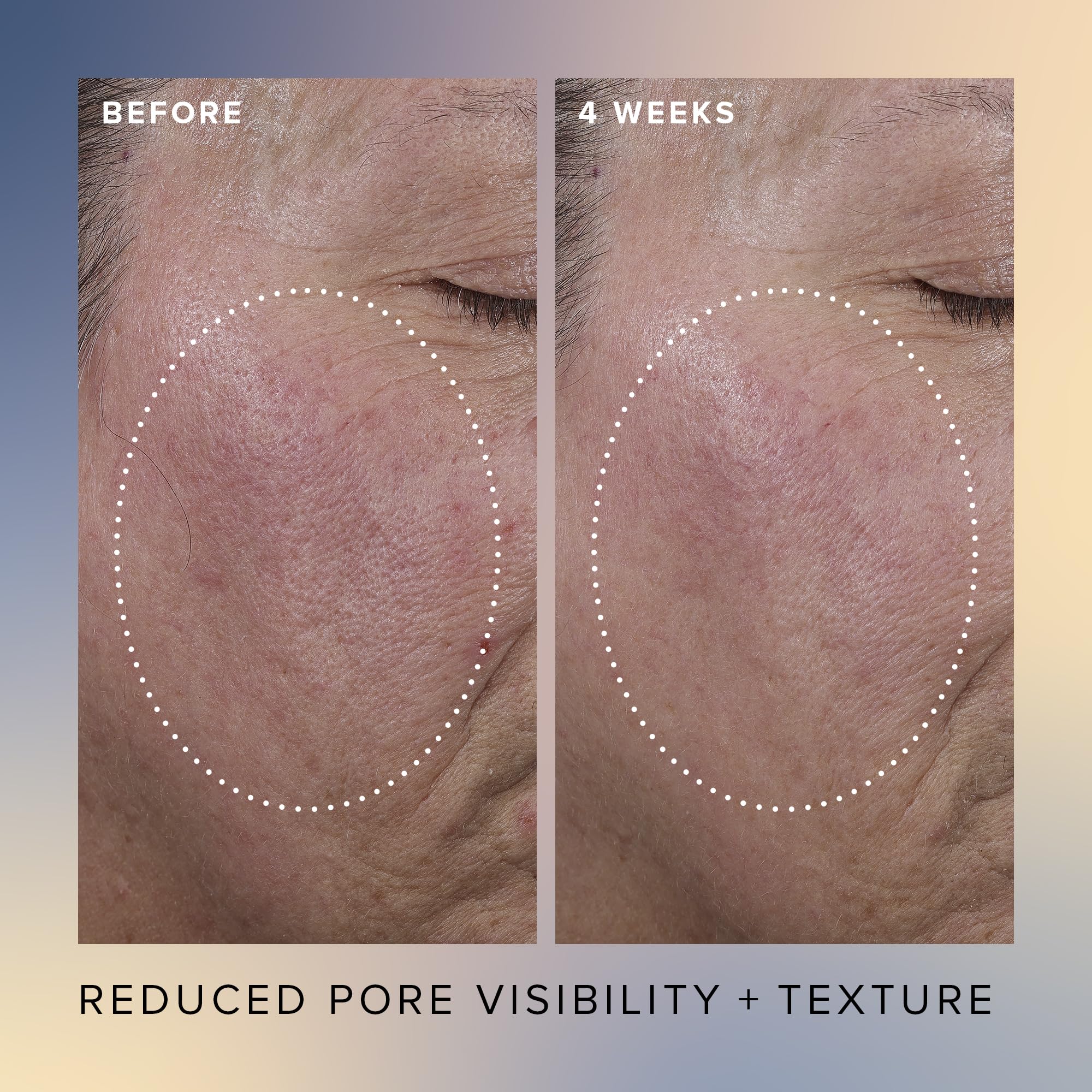 Farmacy Honey Glow Serum application shows 17% AHA/BHA blend for smoother skin.