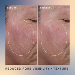 Farmacy Honey Glow Serum application shows 17% AHA/BHA blend for smoother skin.
