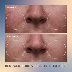 Farmacy Honey Glow Serum buckwheat honey detail emphasizes antioxidant nourishment and brightening potential.