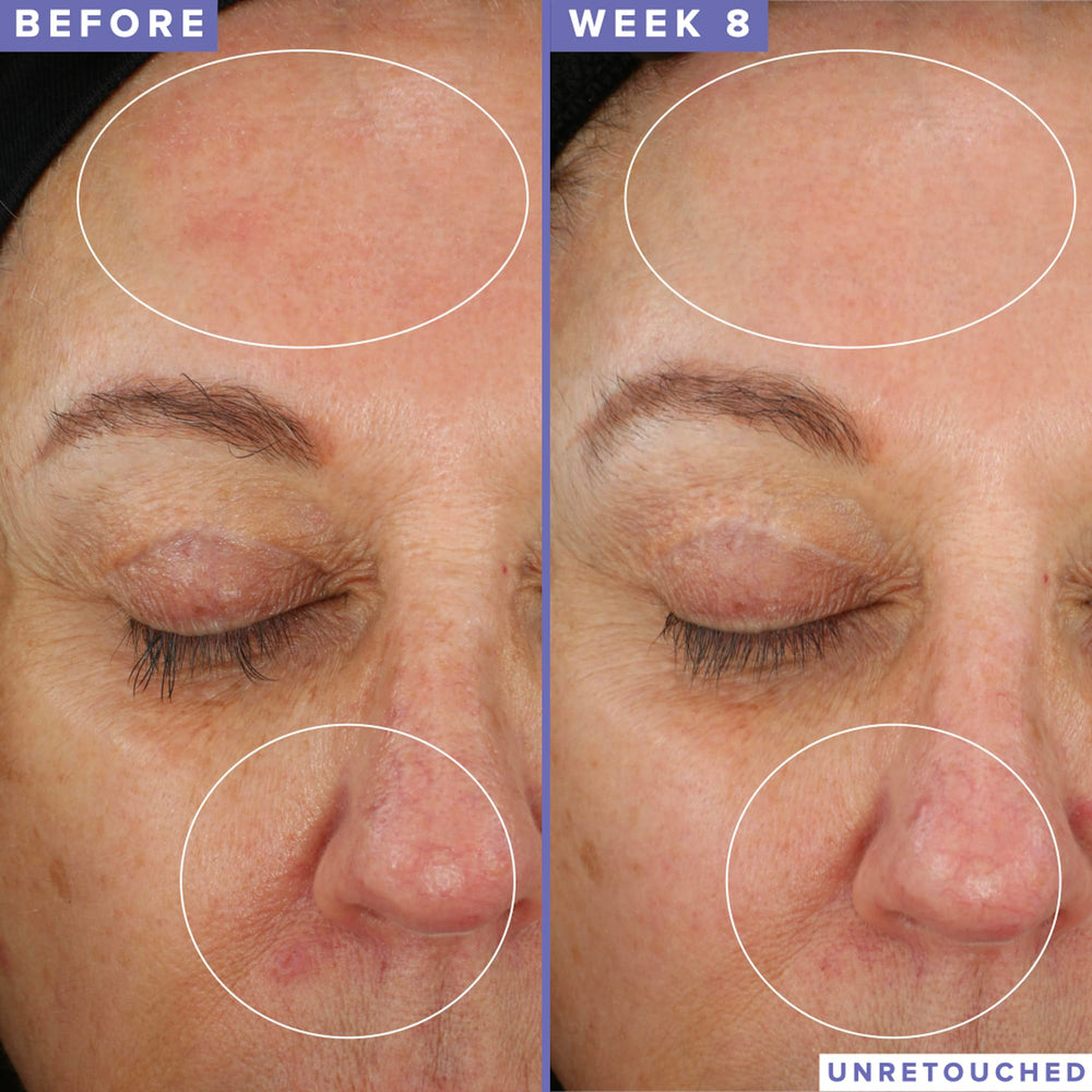 Face after applying Farmacy Niacinamide Overnight Mask shows morning glow and improved tone.