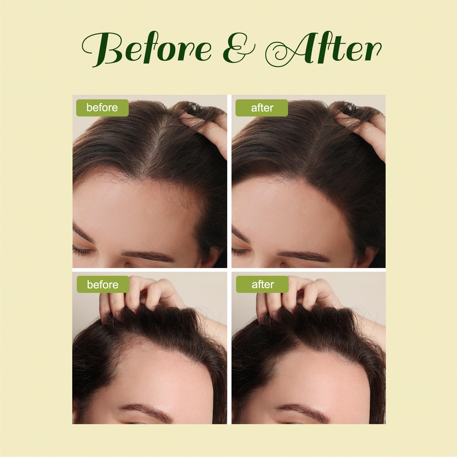 FEIBTH Natural Hair Growth Oil scalp-application scene shows quick massage for hydration.