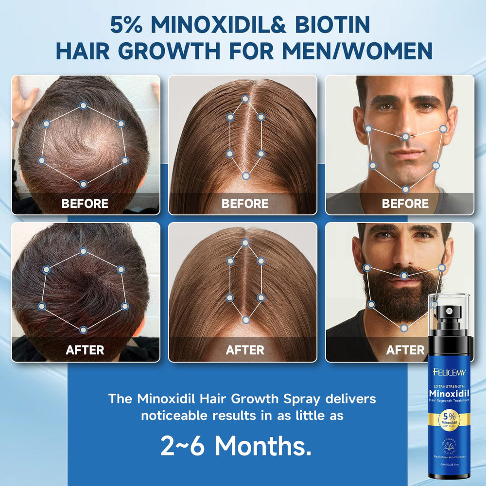 Aplicación rápida y precisa de Felicemy Minoxidil 5% spray.