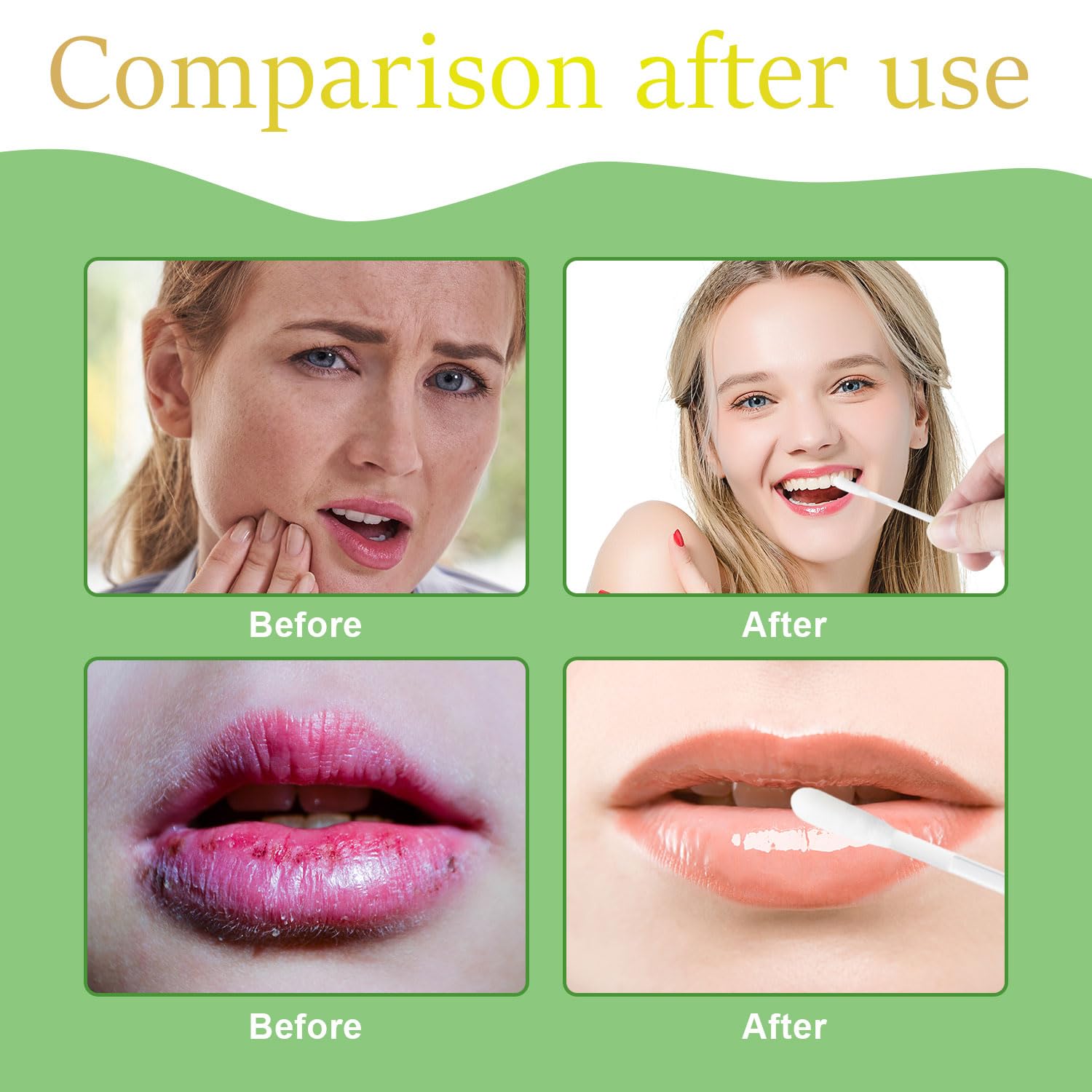 Fenshine single-use design reduces cross-contamination during lip care.
