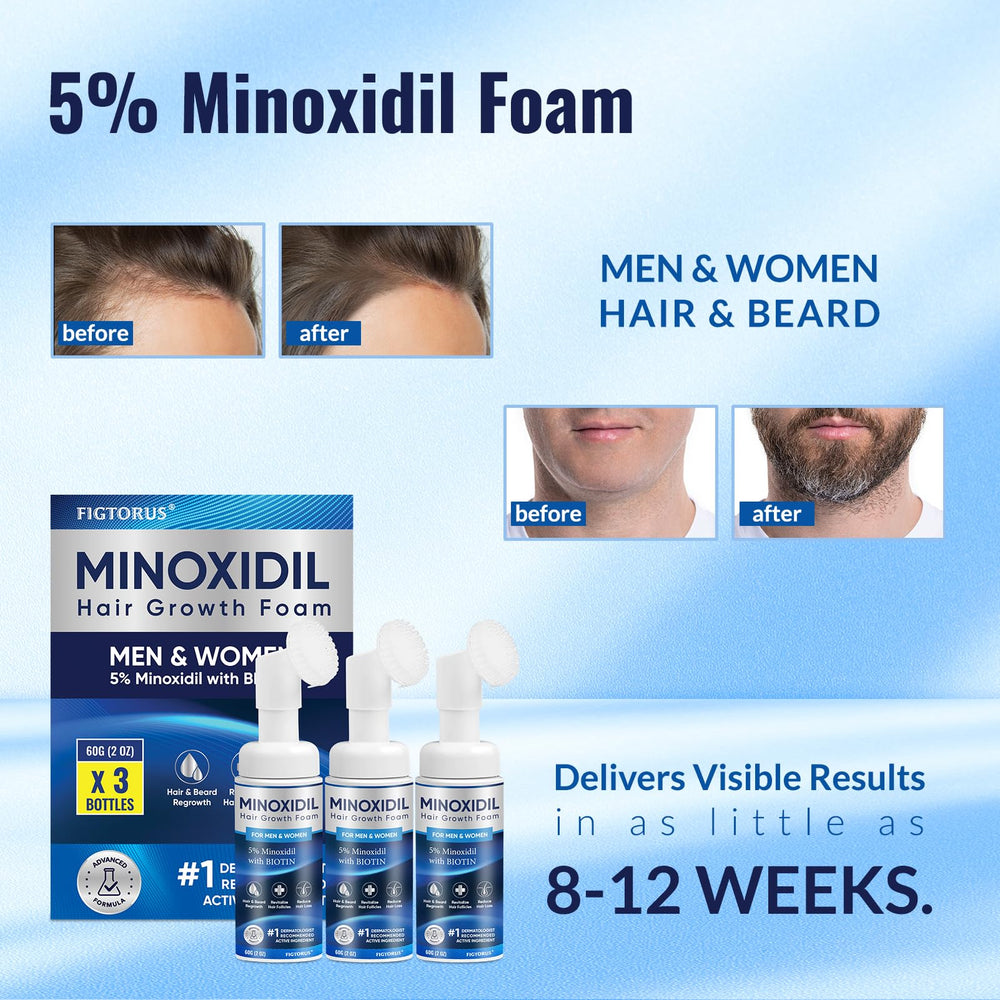 FIGTORUS packaging highlights 5% Minoxidil with Biotin and castor oil benefits.