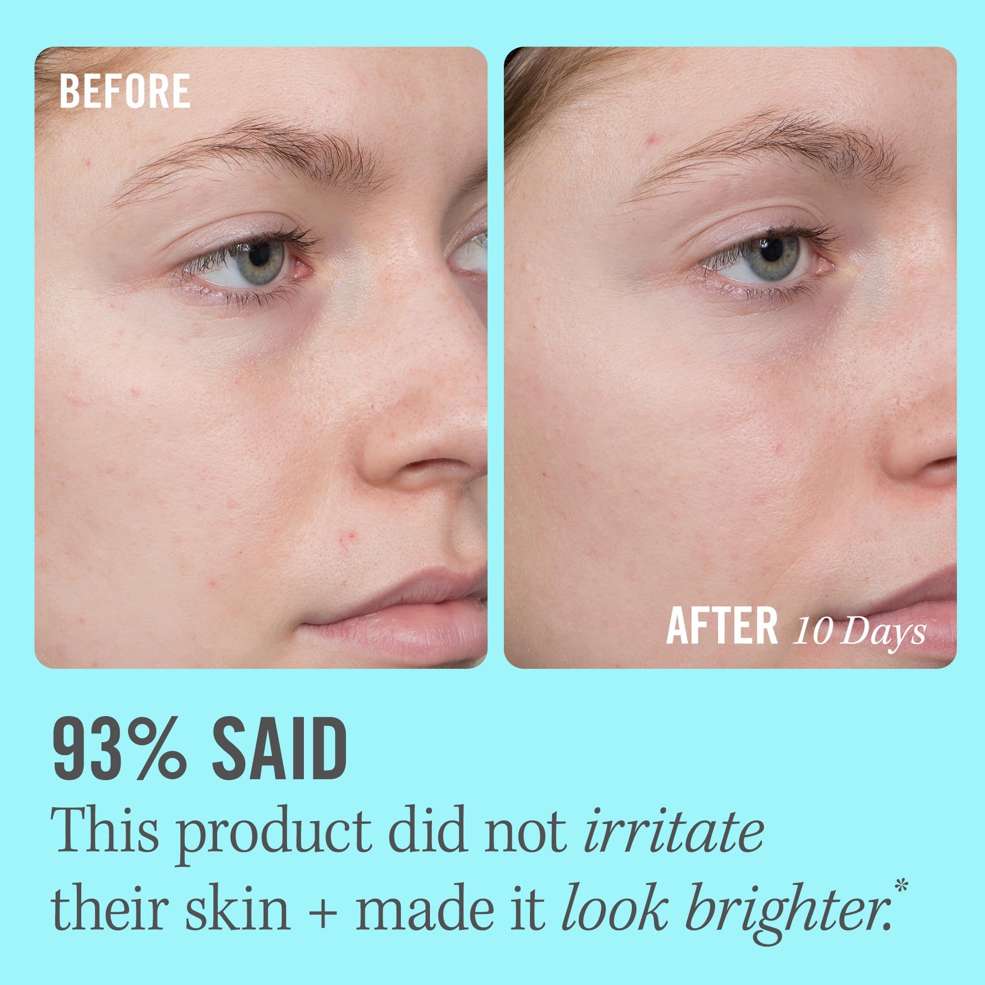 Applying First Aid Beauty serum on face and neck in the morning
