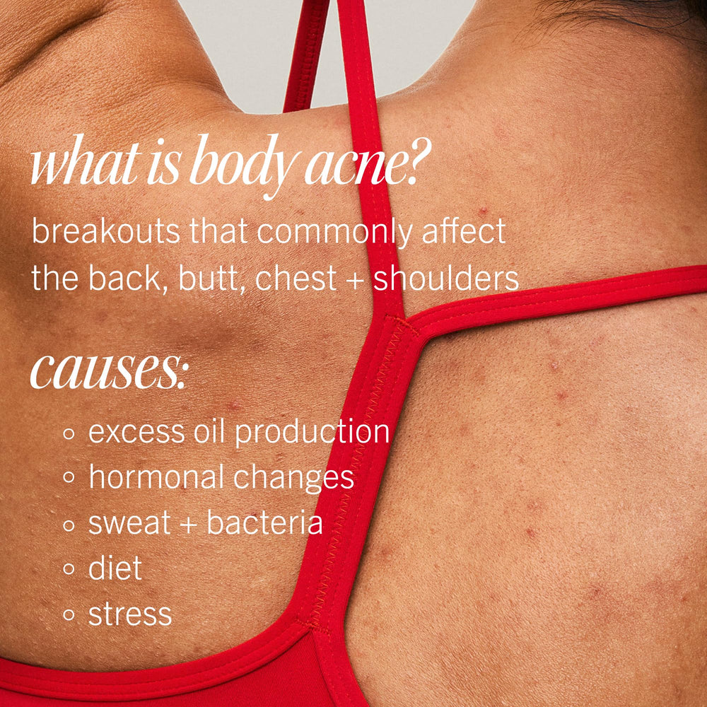 First Aid Beauty spray ideal after workouts for quick, fresh skin