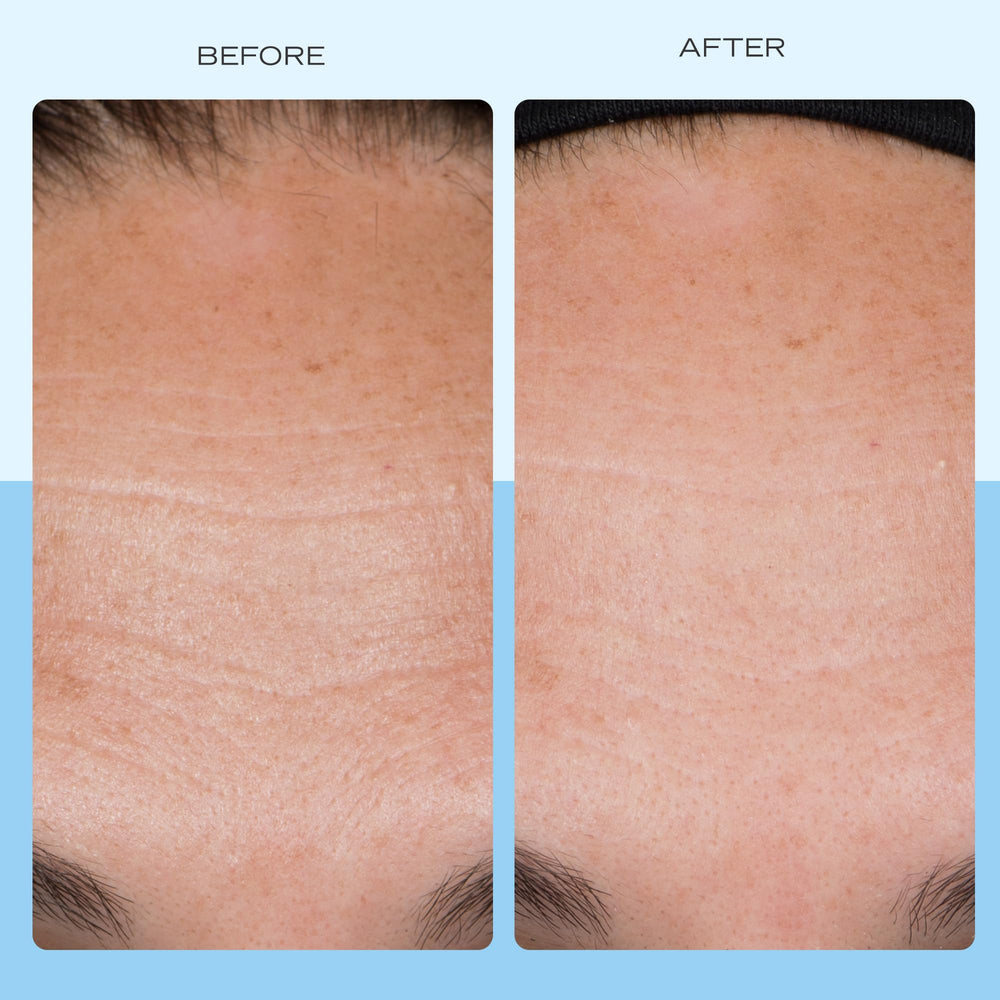 Key ingredients of First Aid Beauty Firming Collagen Cream displayed on a white background.