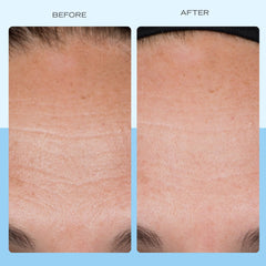 Key ingredients of First Aid Beauty Firming Collagen Cream displayed on a white background.