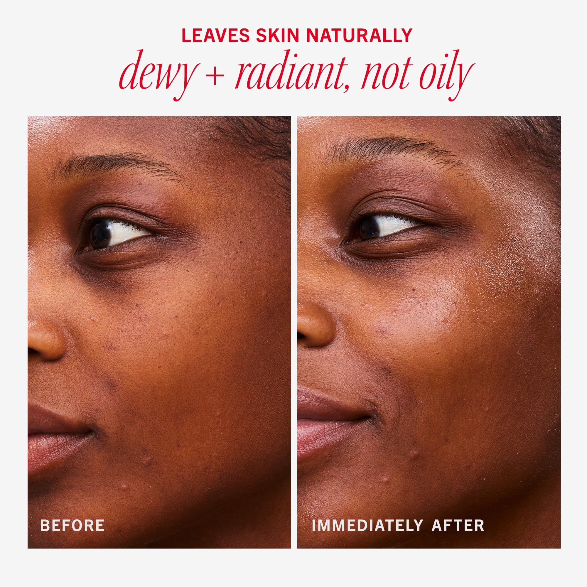 First Aid Beauty Hydrating Dewy Gel Cream on porcelain skin suggests subtle dewy finish