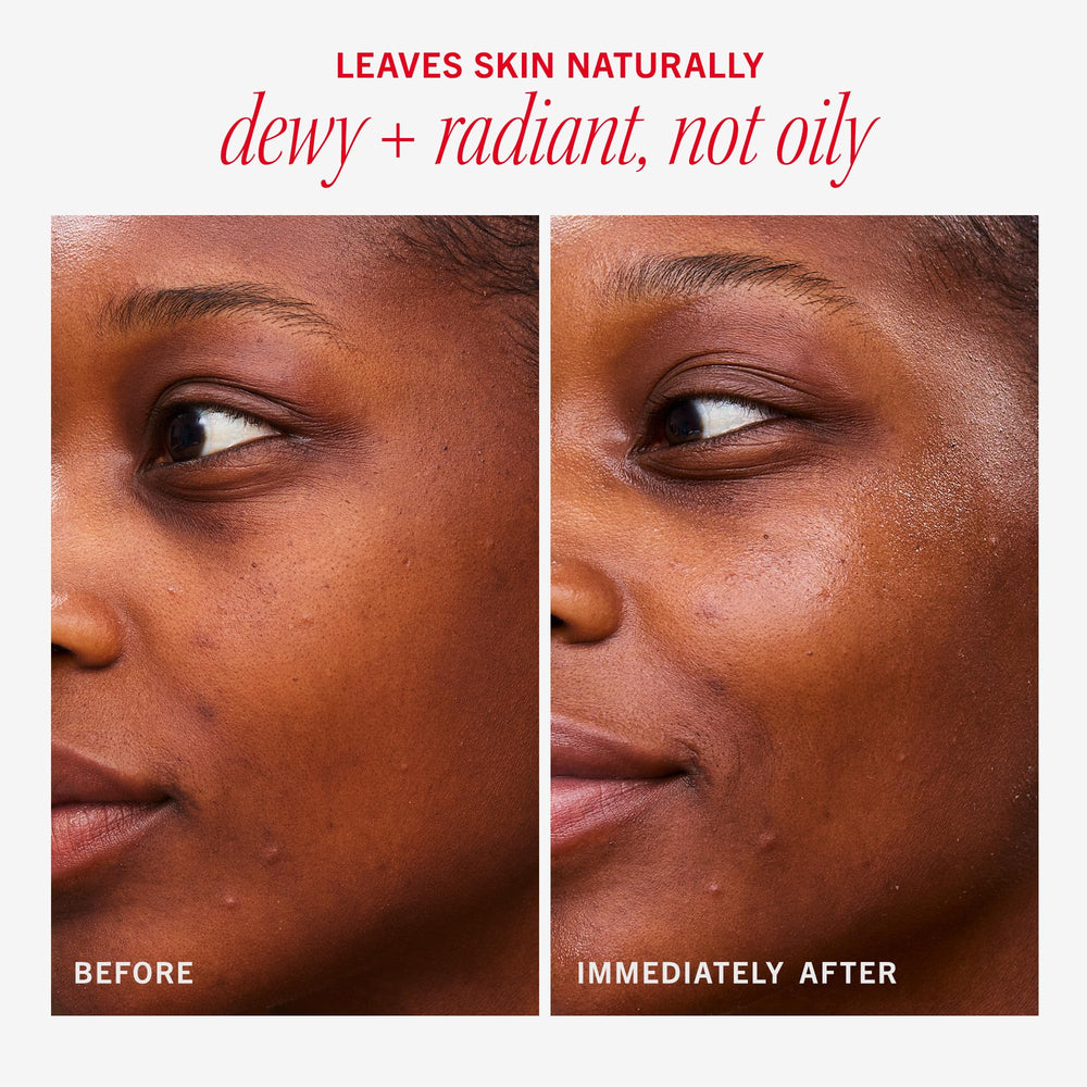 First Aid Beauty Hydrating Dewy Gel Cream on porcelain skin suggests subtle dewy finish