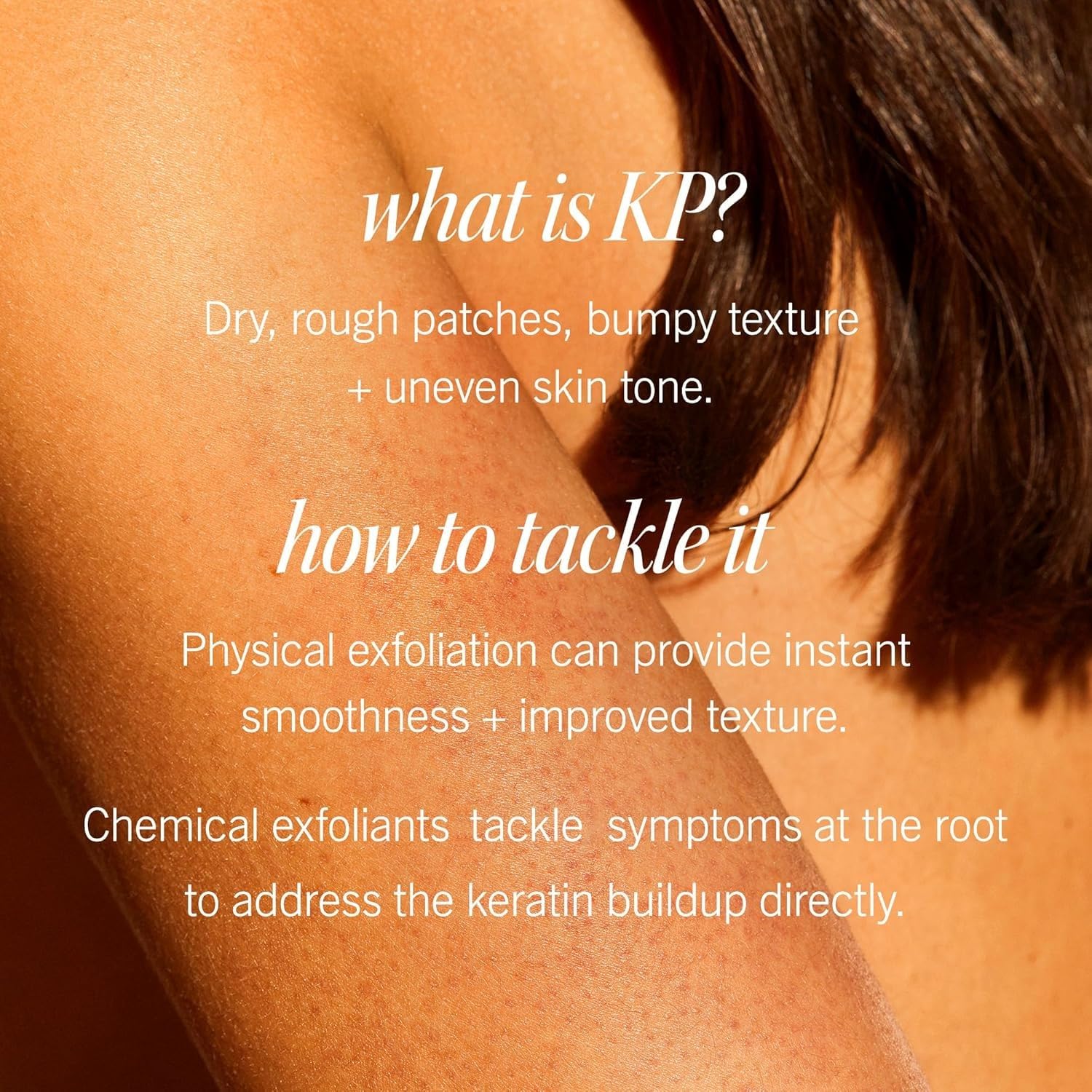 First Aid Beauty KP Bump Eraser being applied on arm shows smoothing action