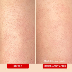 First Aid Beauty KP Bump Eraser pumice beads closeup for effective exfoliation