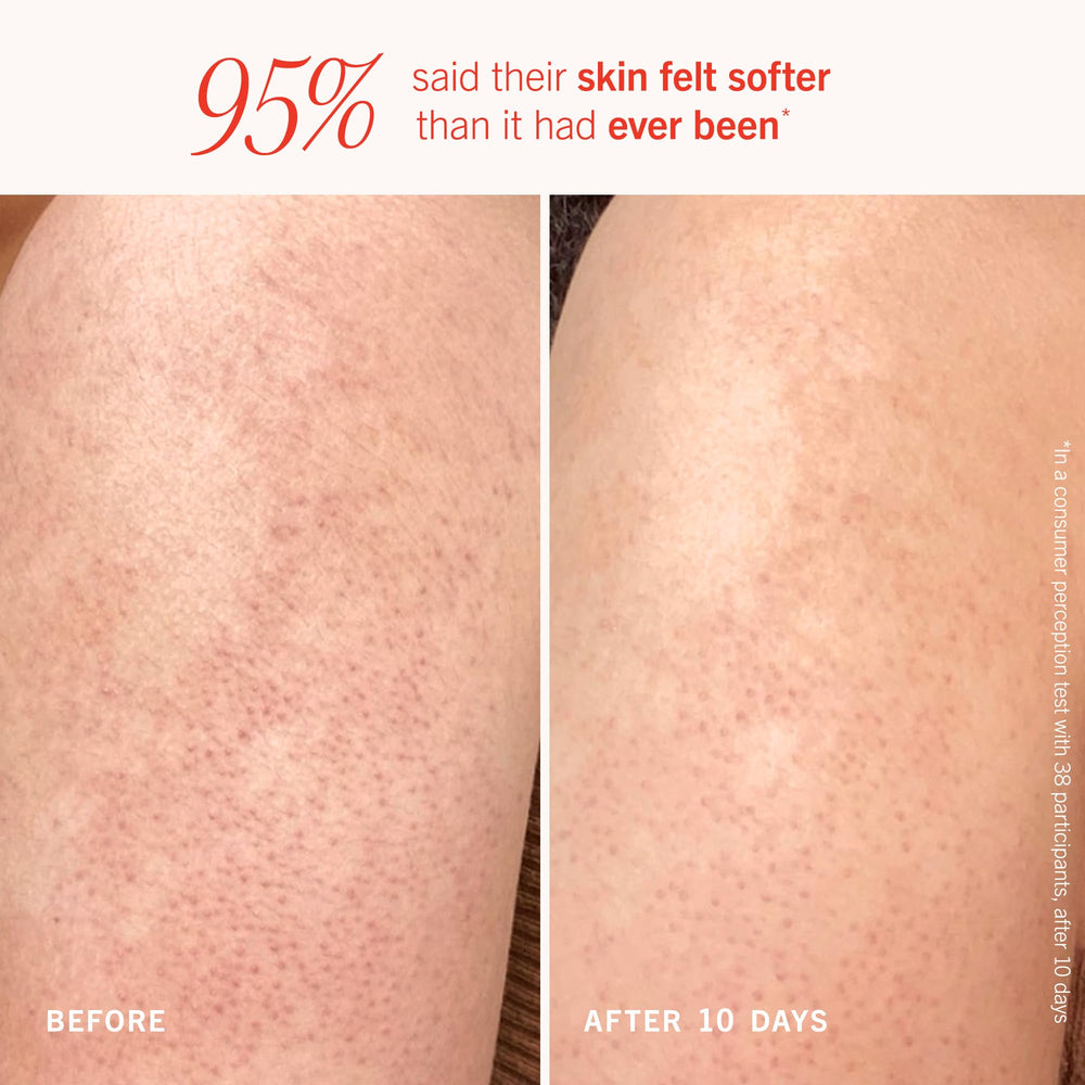 First Aid Beauty KP scrub pumice beads close-up reveals physical exfoliation texture
