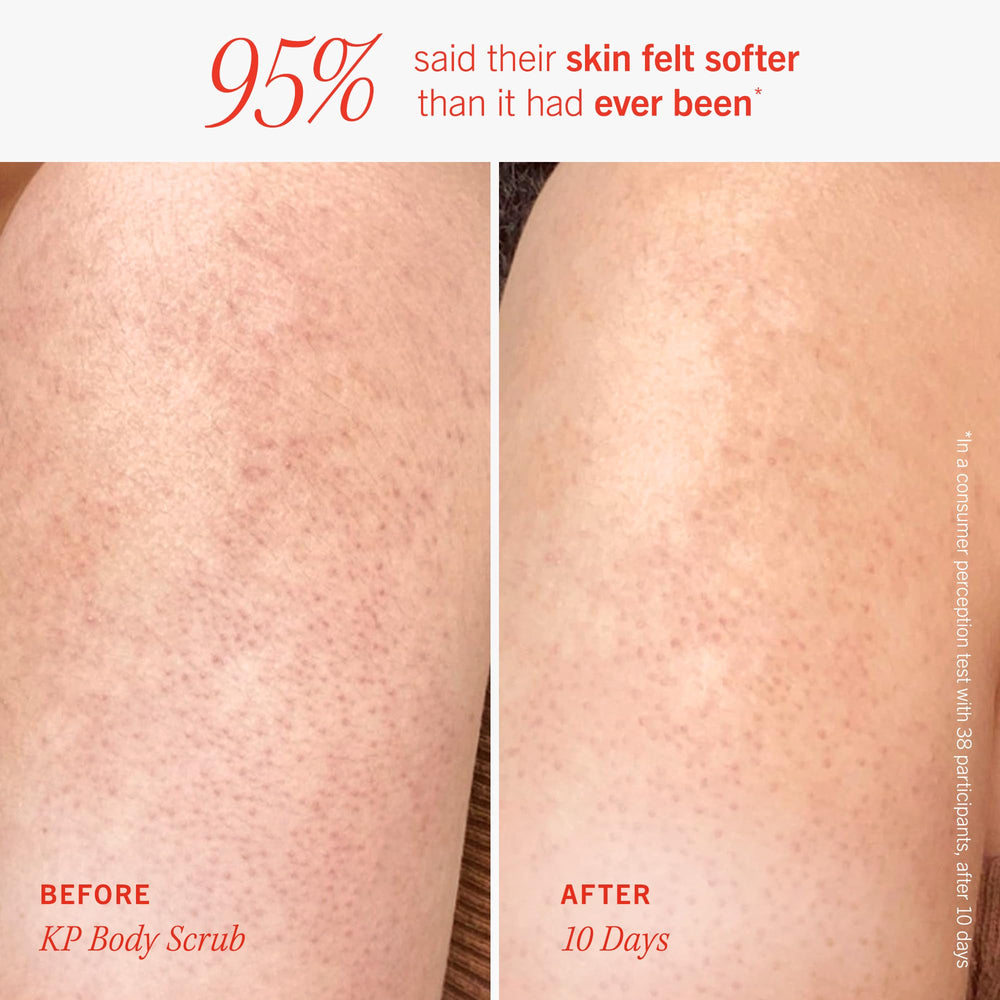 First Aid Beauty Peach-scented lotion close-up shows refreshing fragrance with hydrating formula.