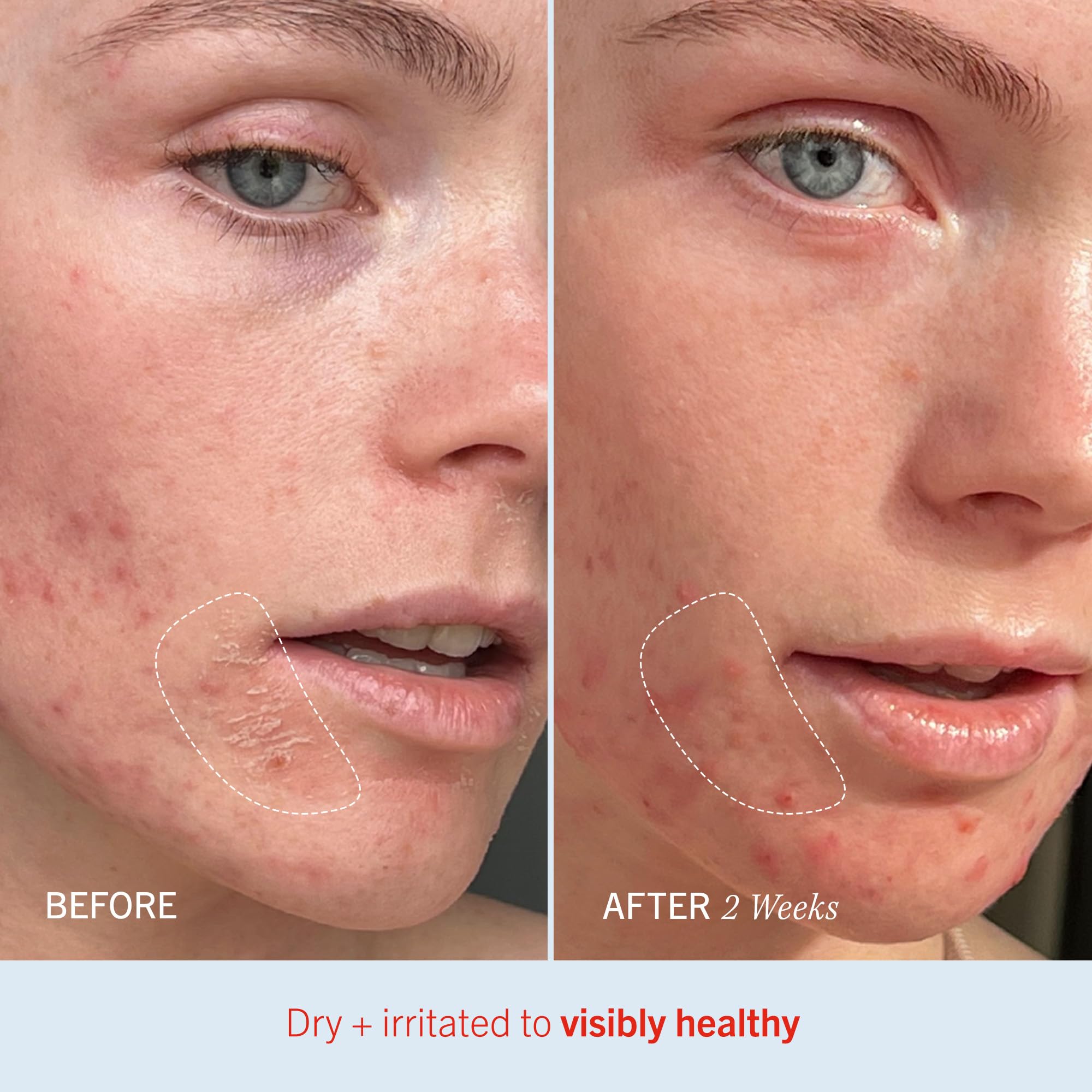 First Aid Beauty Ultra Repair Cream colloidal oatmeal ingredient closeup.