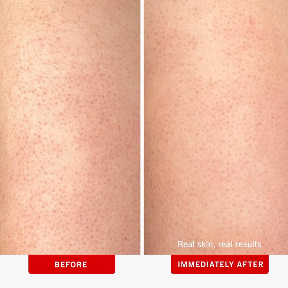 First Aid Beauty KP Bump Eraser pumice beads visible for gentle buffing away roughness