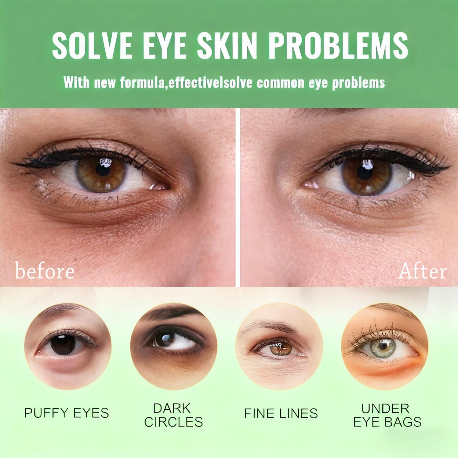 Firstfly dark circles and puffiness relief patches applied under eyes.
