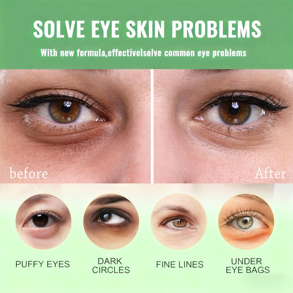 Firstfly dark circles and puffiness relief patches applied under eyes.