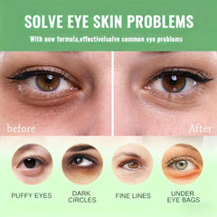 Firstfly dark circles and puffiness relief patches applied under eyes.