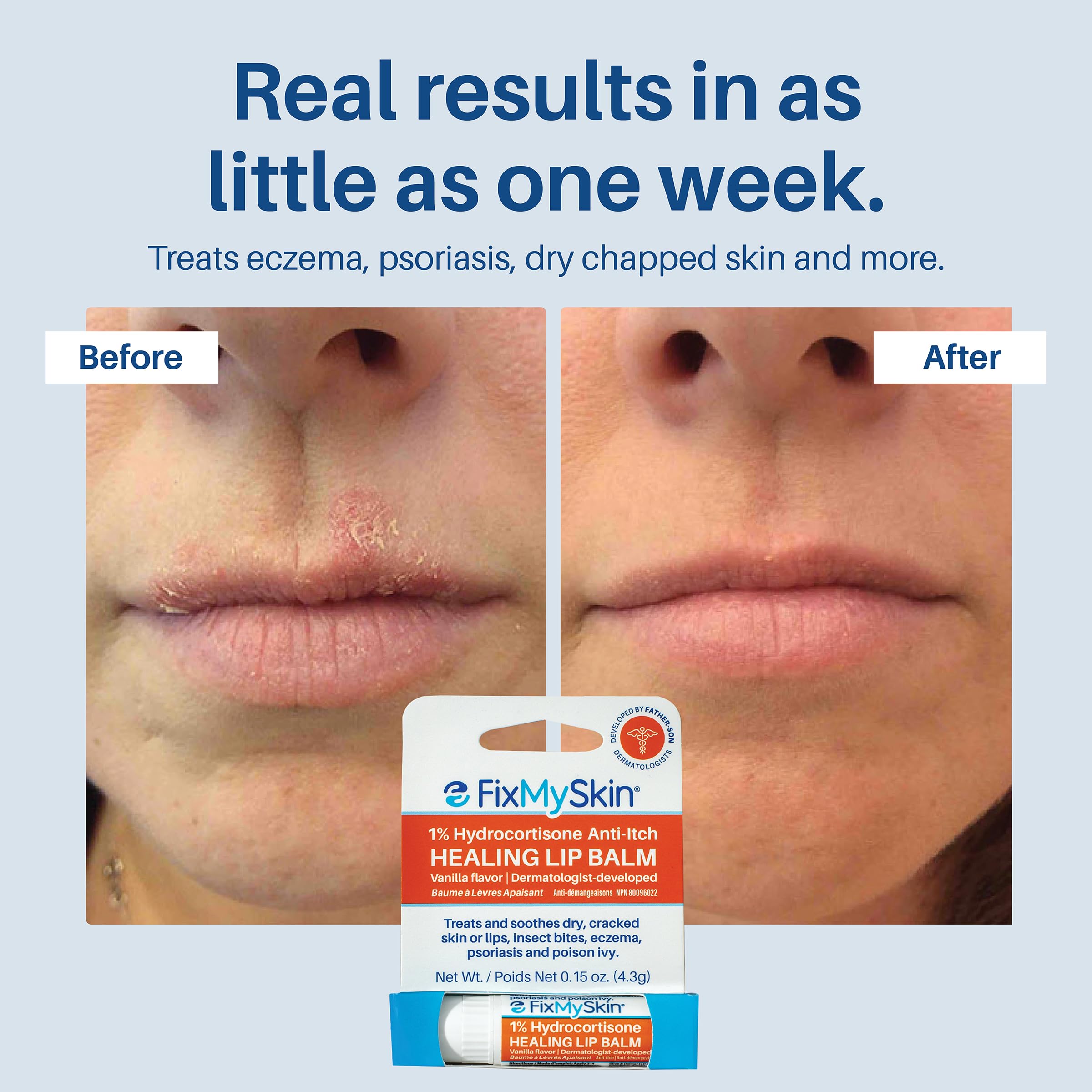 Close-up texture of balm forming a protective layer on lips.