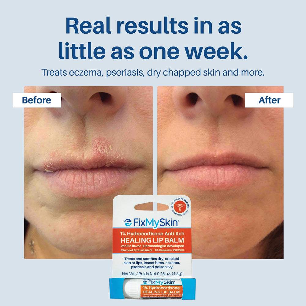 Close-up texture of balm forming a protective layer on lips.