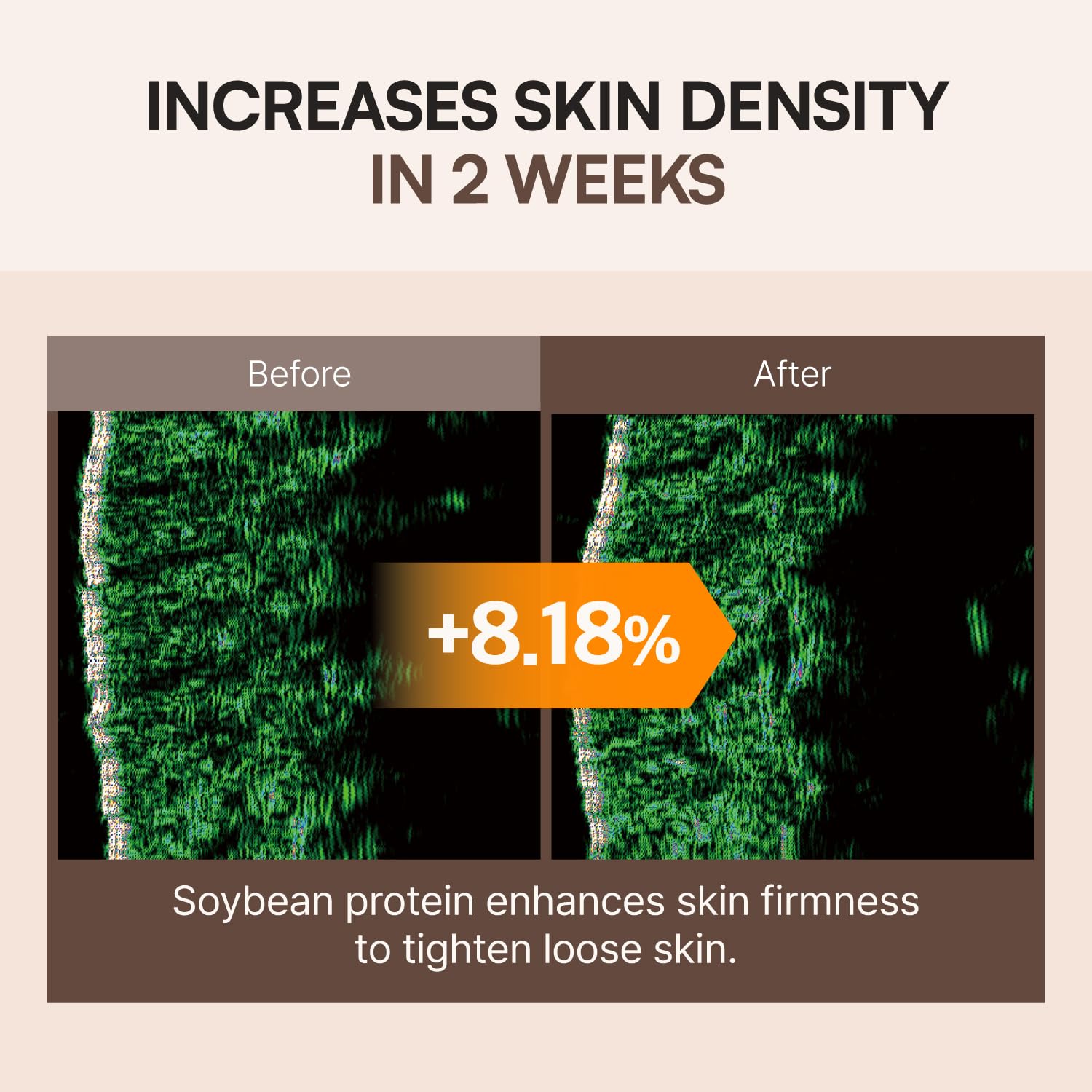 FLASKIN Biome elasticity illustration suggesting healthier skin texture