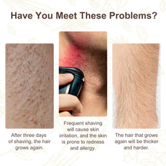 After hair removal, Flasture oil soothes redness and irritation.