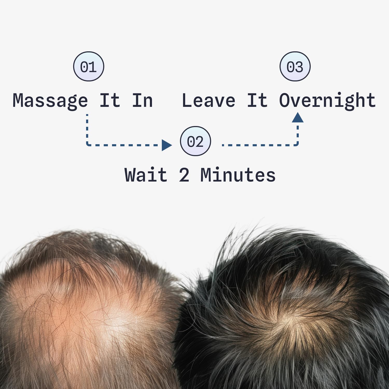 Fleava Serum clears scalp—promotes healthier circulation and density.