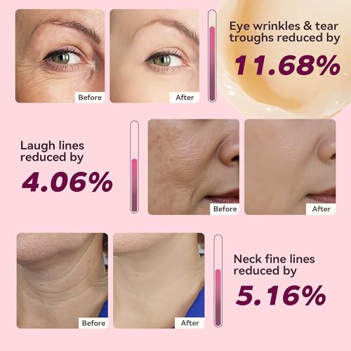 Fleur Luxxe Calcium Multi Balm Stick in use for easy application.